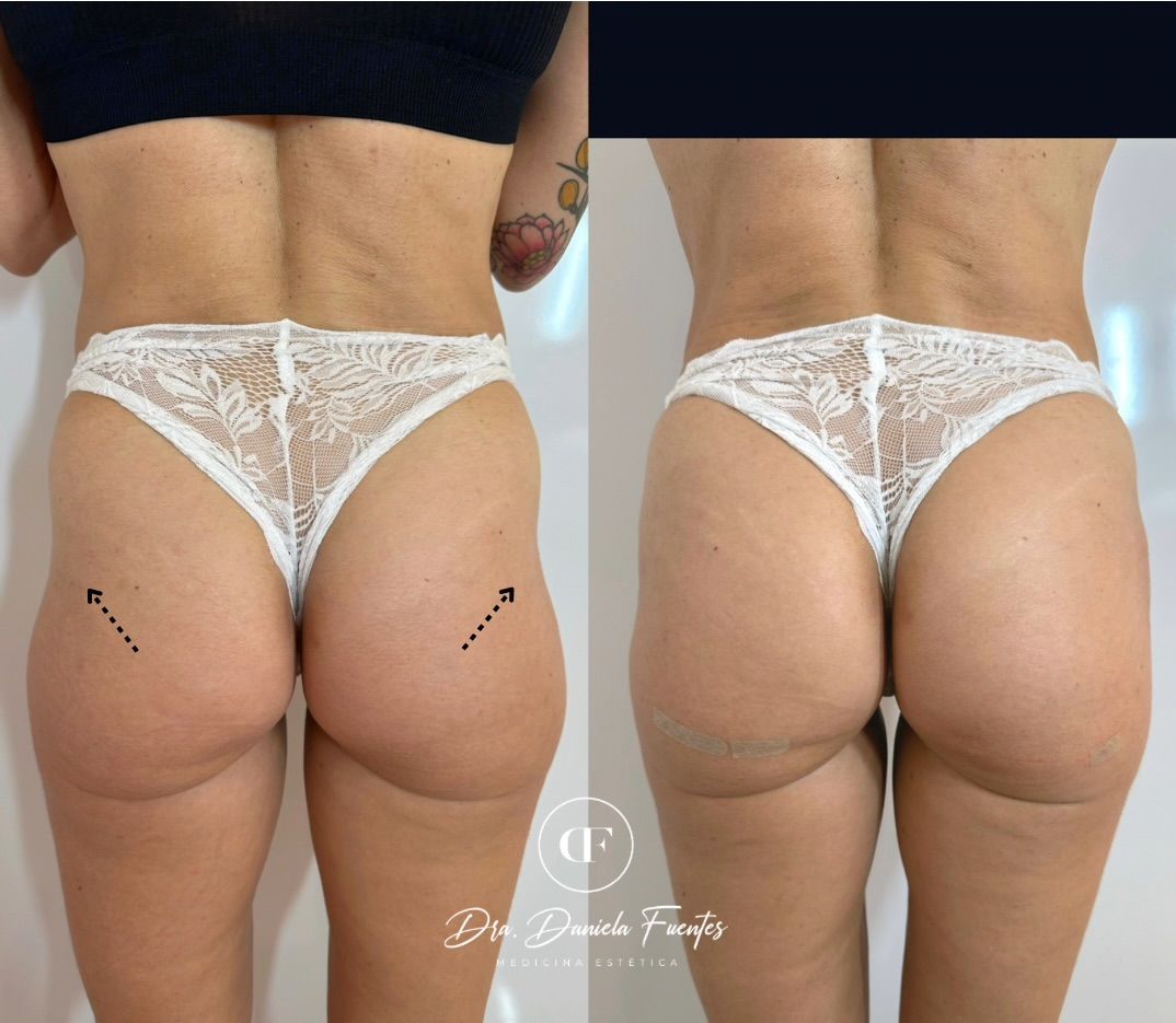 Daniela Fuentes Ortiz-16