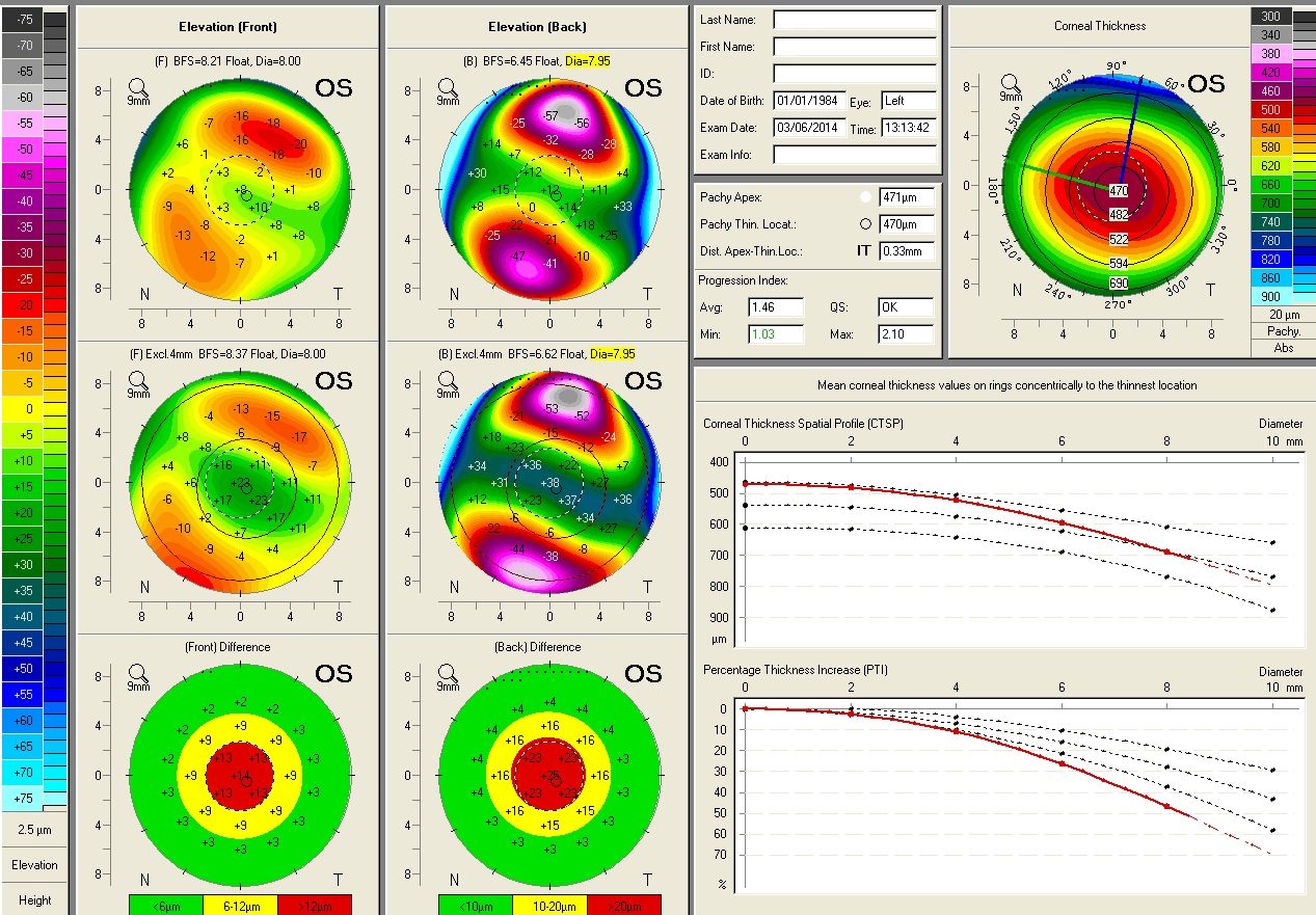 Murat Ünlüzeybek-0