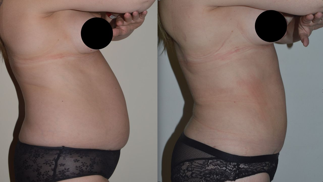 Michele Antonacci-14