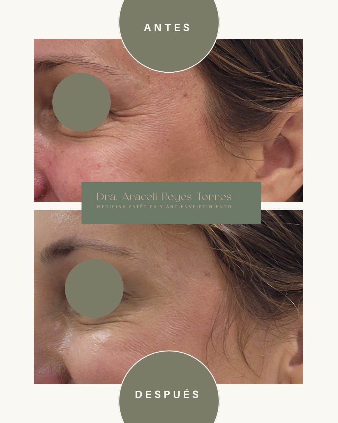 Araceli Reyes Torres-6