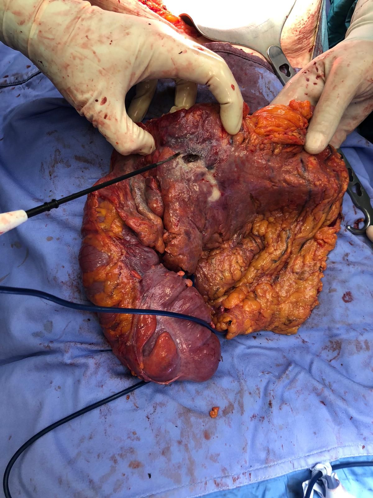 Antonio Ferronetti-2