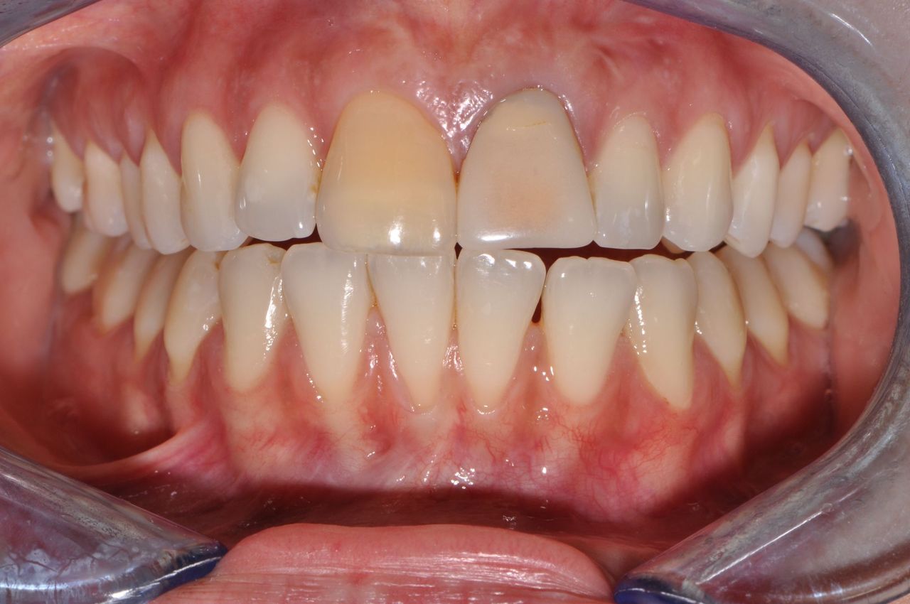 Riccardo Giardina-23