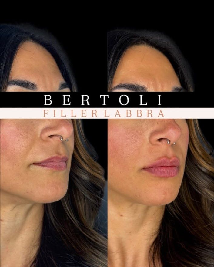 Andrea Bertoli-30