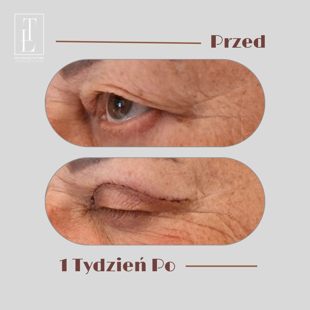 Łukasz Tatara-11