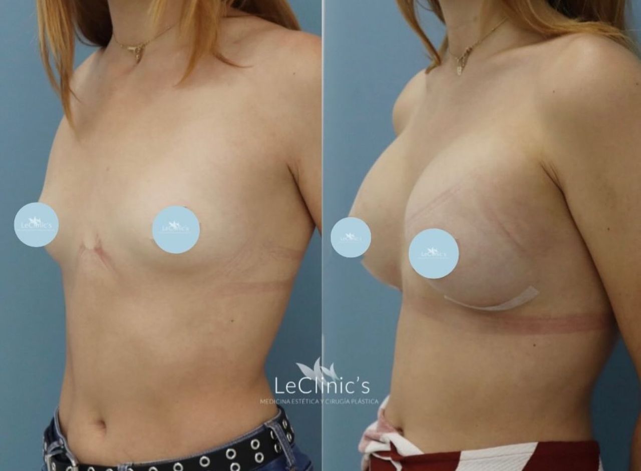 Irasema Regla Bezares Ramos-1