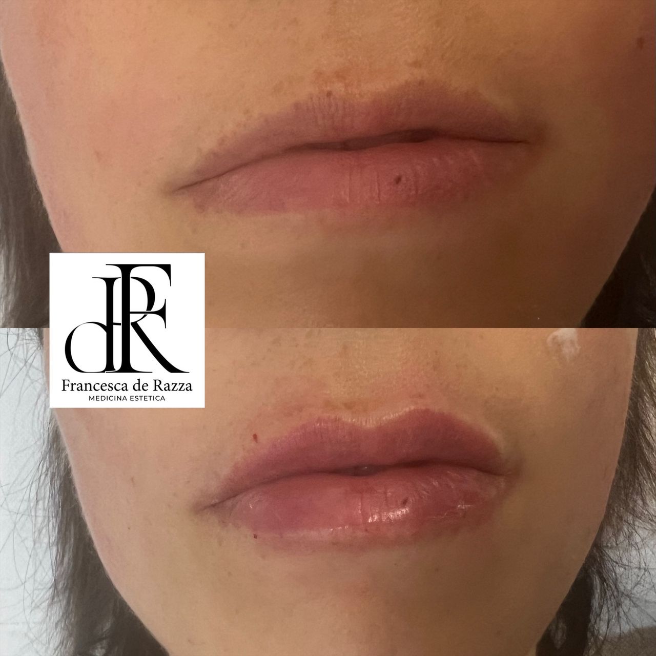 Francesca De Razza-73