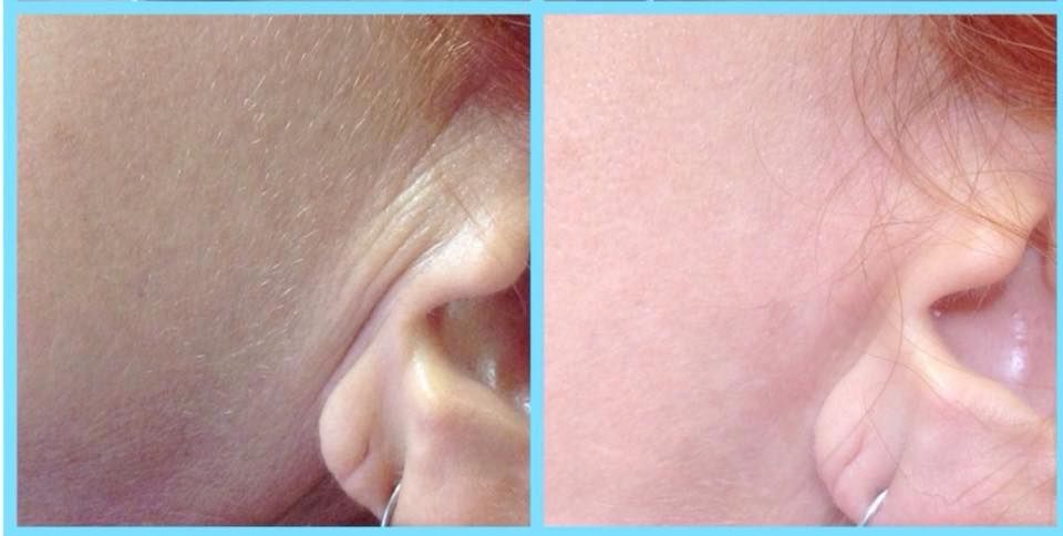 Anita Orzechowska-10