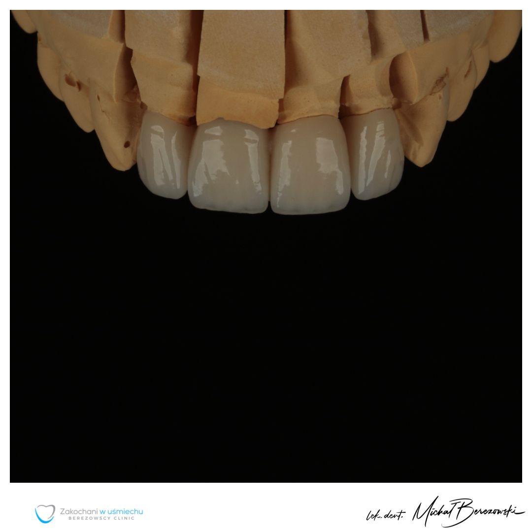 Michał Berezowski-16