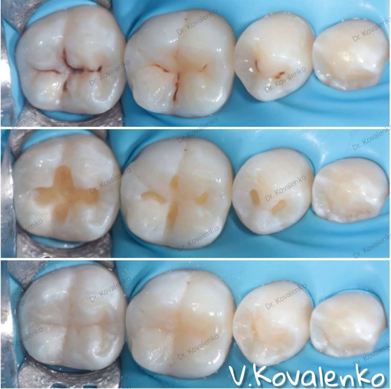 Viktoriia Kovalenko-0