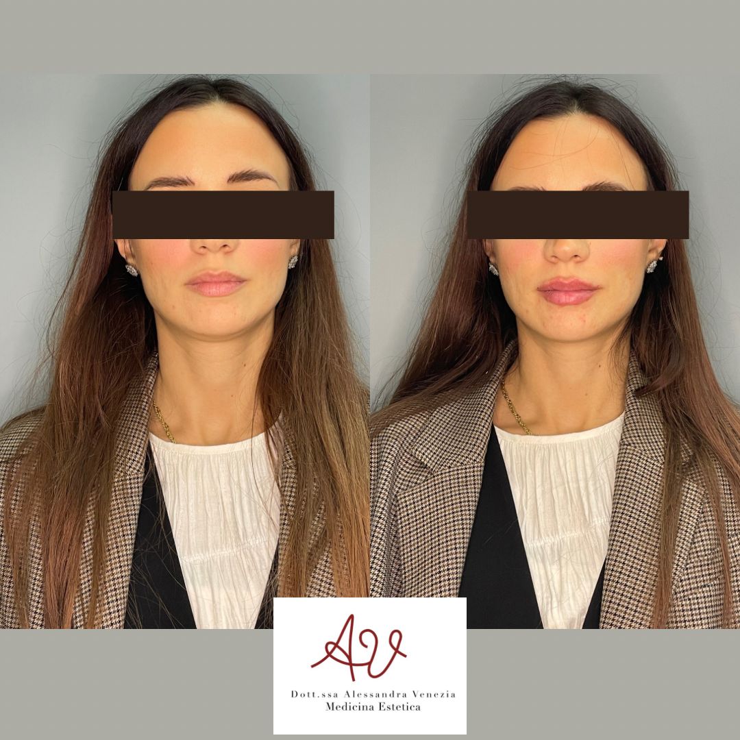 Alessandra Venezia-14