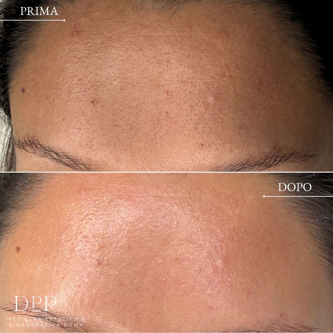 Davide Prosperi Porta-17