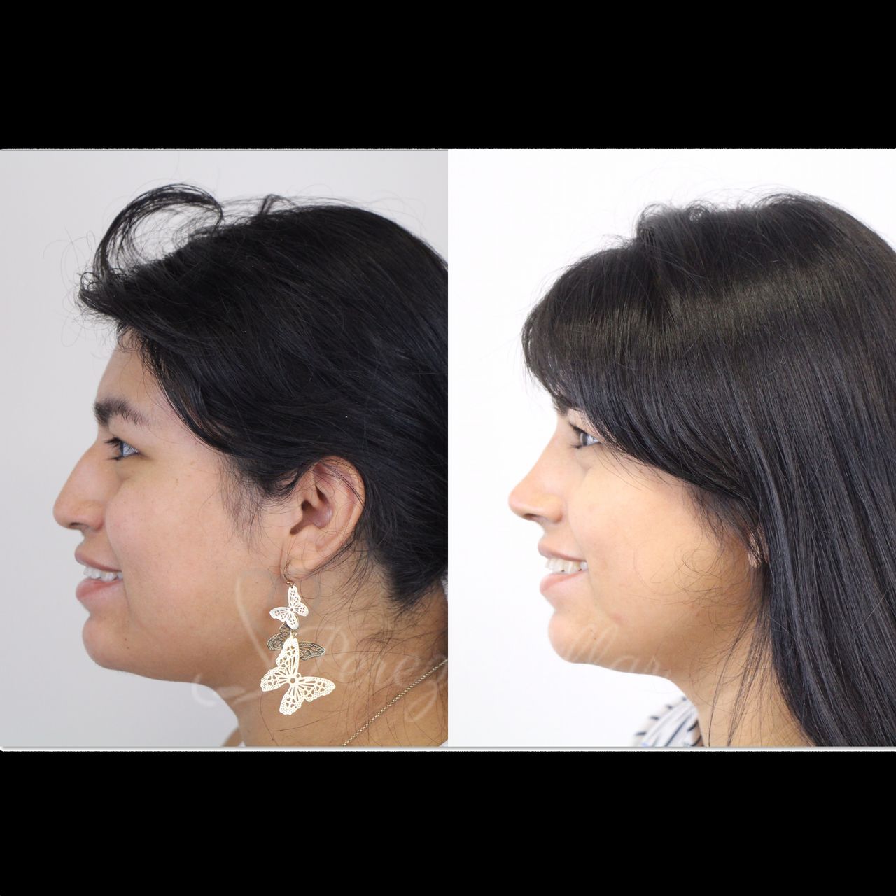 Alvaro Perez Villar-2