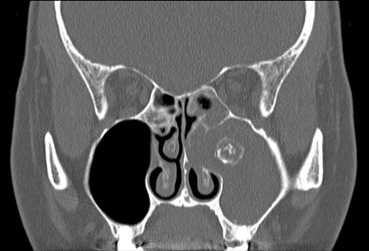 Francesco Zappoli Thyrion-9