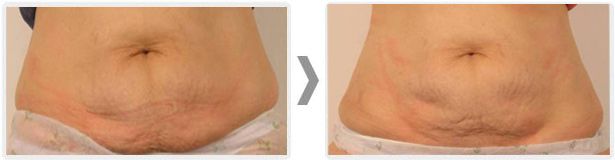 Anita Orzechowska-16