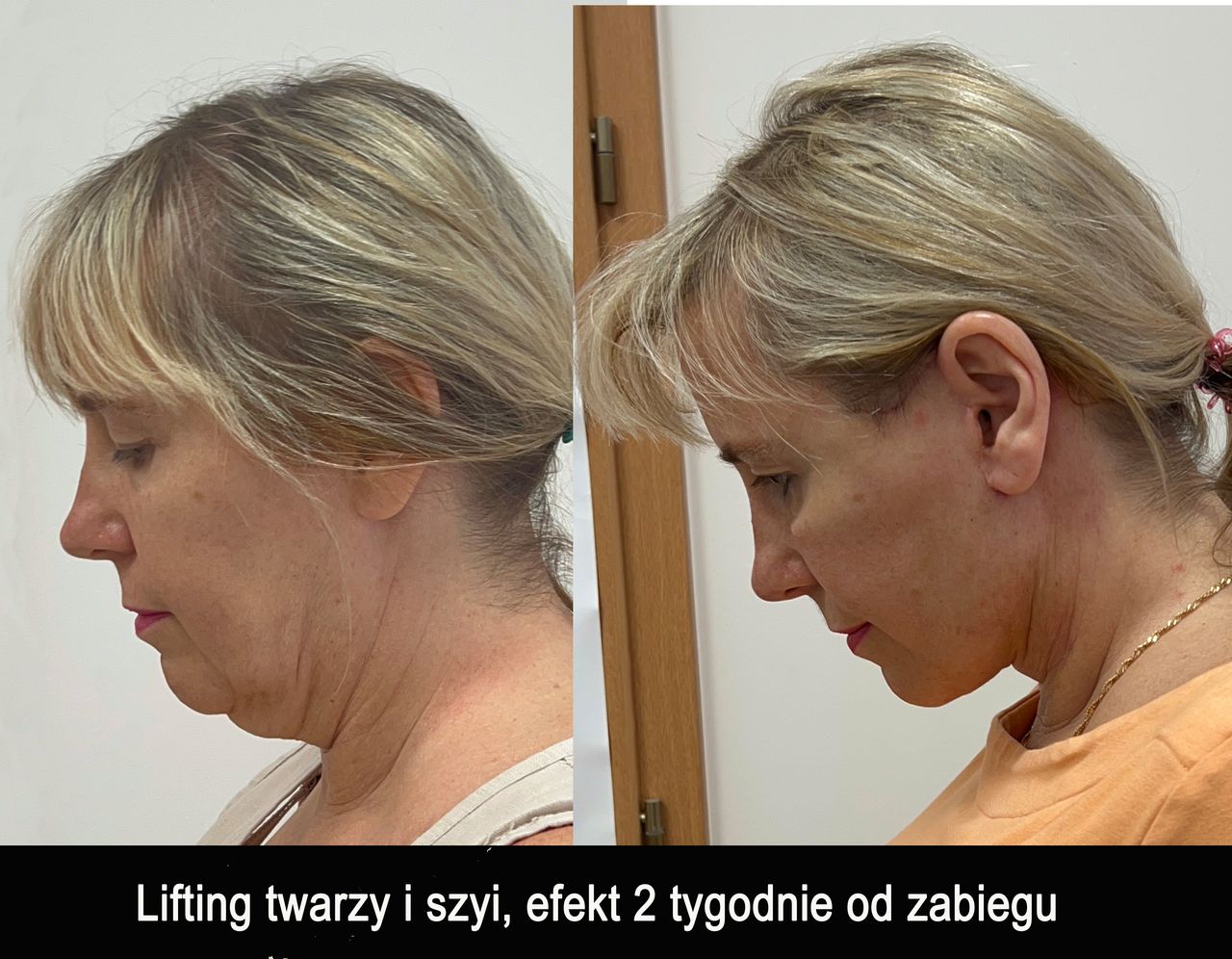 Mariusz Zagajewski-39