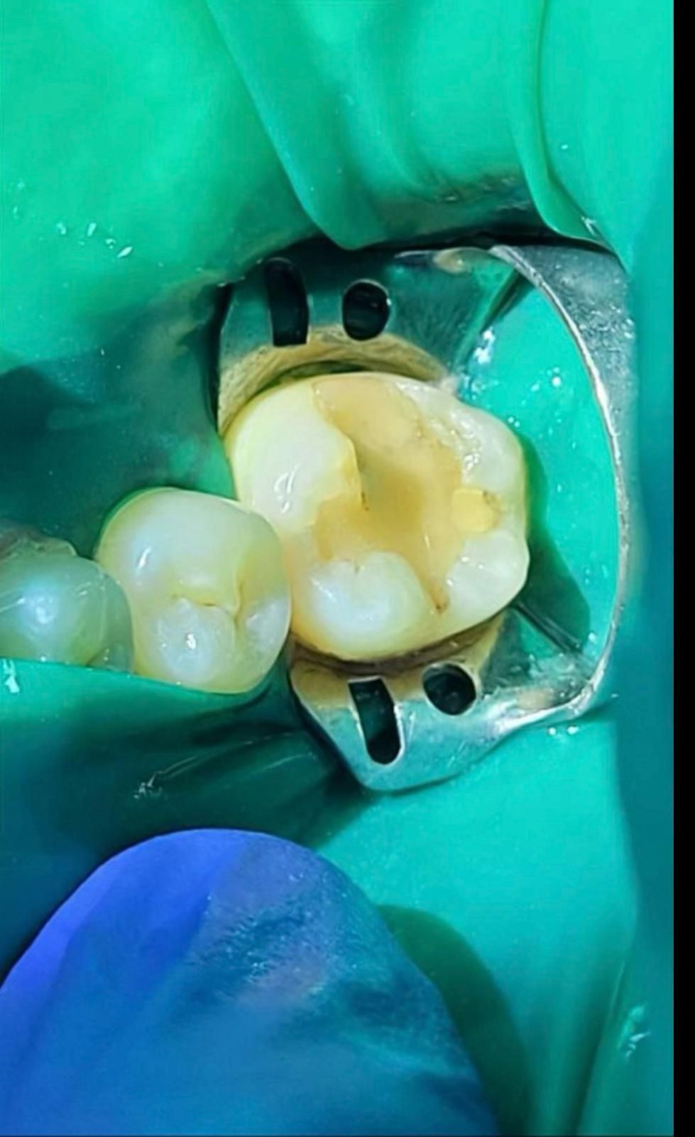 Viktoriia Dikhtiarenko-9