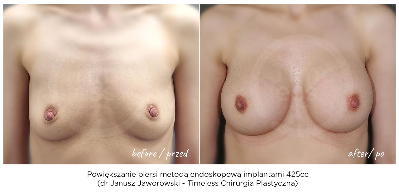 Janusz Jaworowski-157