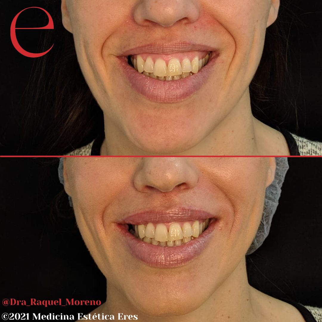 Raquel Moreno Pentinel-92