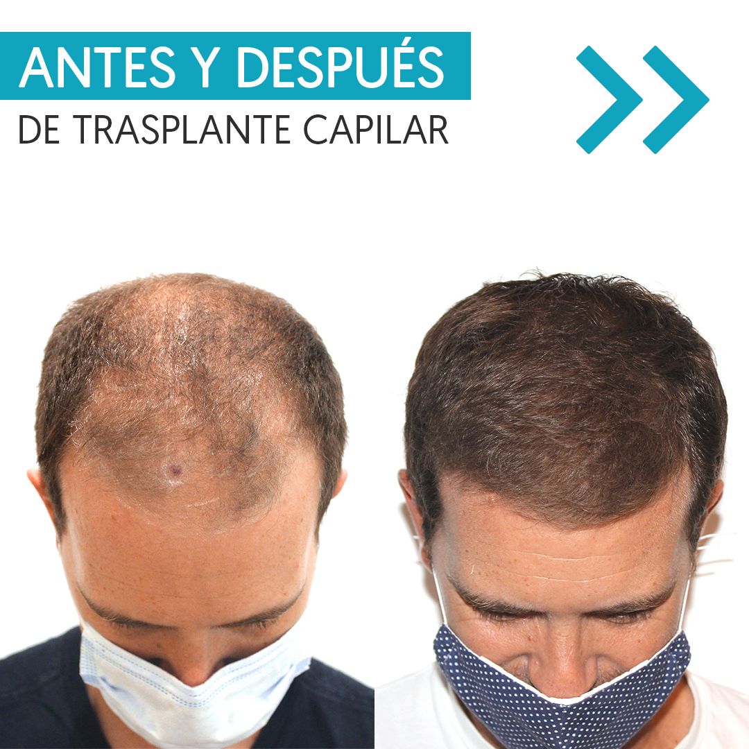 Karlexis León Montilla-6