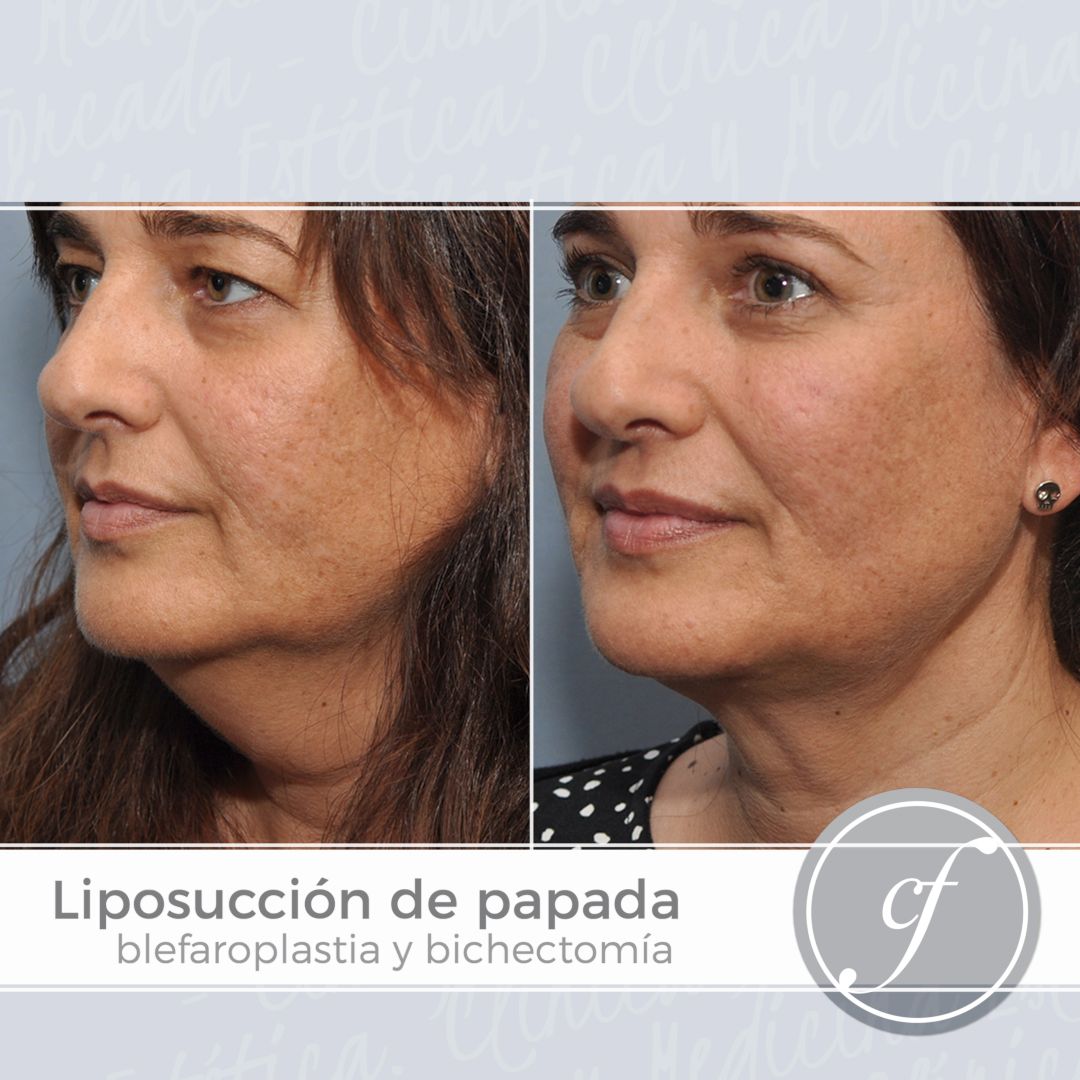 Eduardo Forcada Melero-18