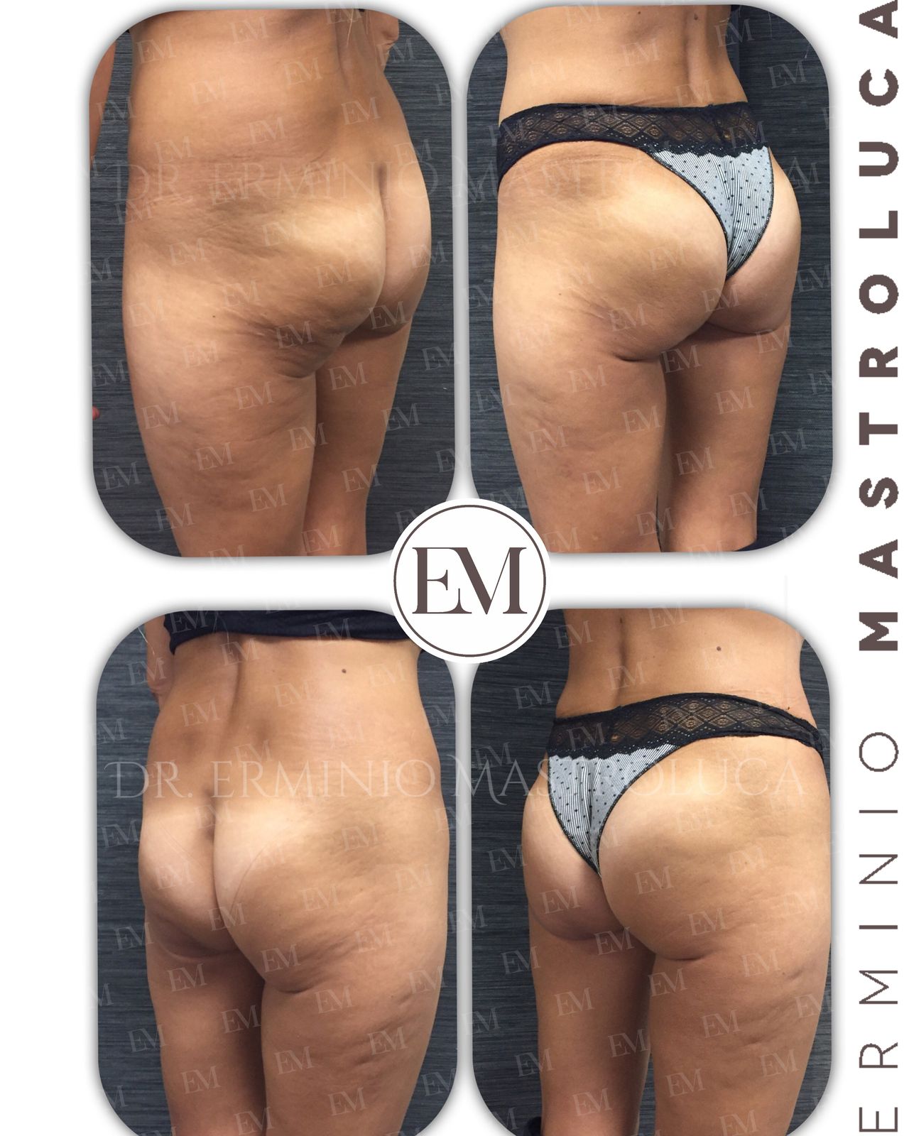 Erminio Mastroluca-5