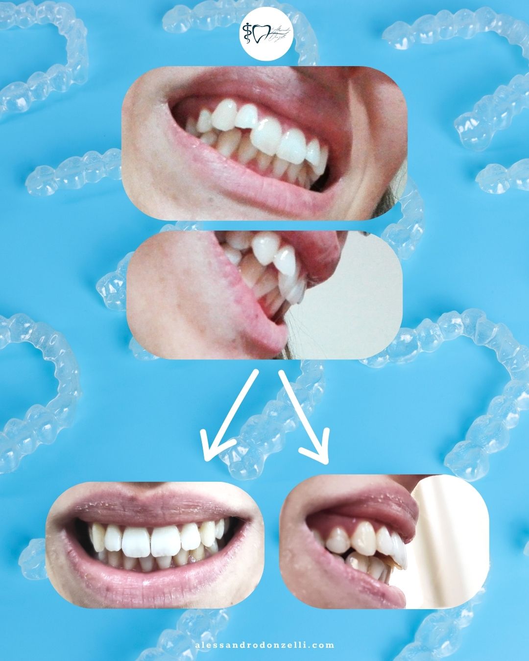 Alessandro Donzelli-12