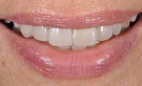 Paolo Bastianelli-19