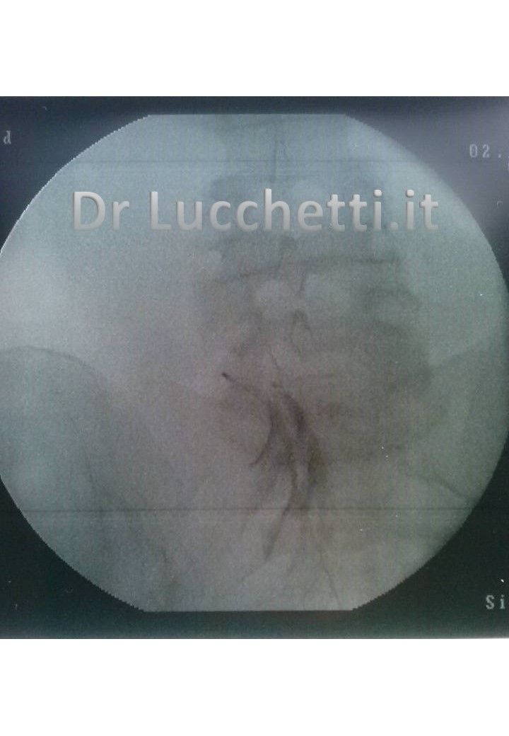 Francesco Lucchetti-2