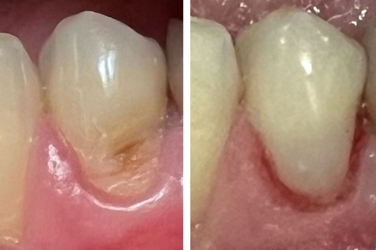 Federica Del Villano-5