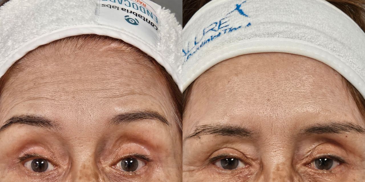 Rosalba Herrero Zerpa-565