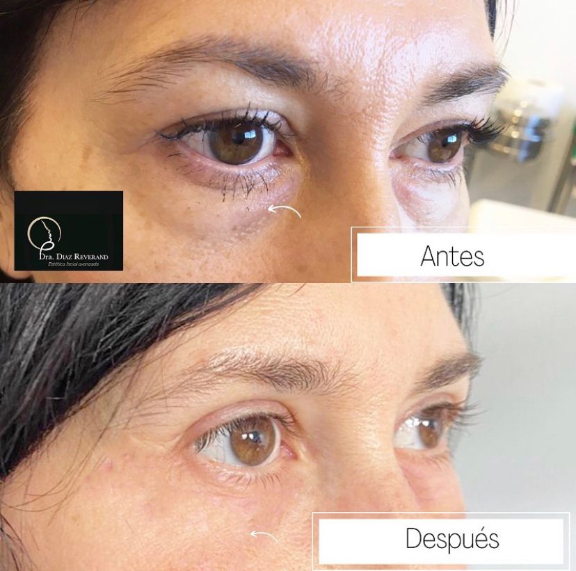 Susan Diaz Reverand-11