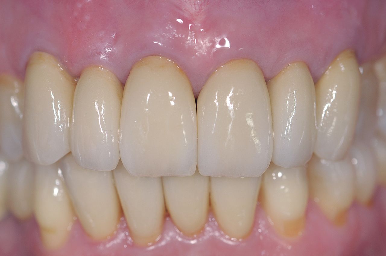 Stefano De Simone-128