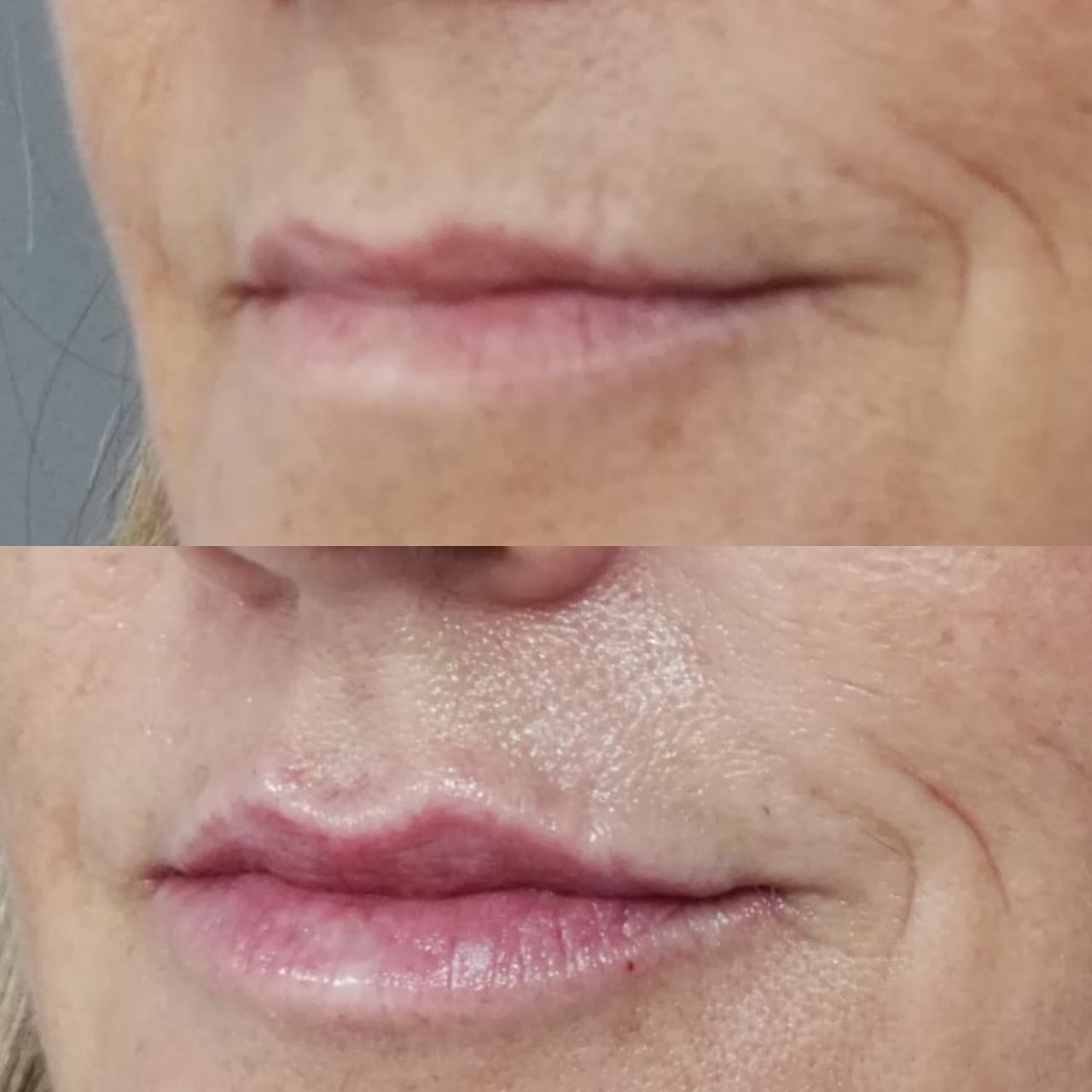 Rosalba Herrero Zerpa-235