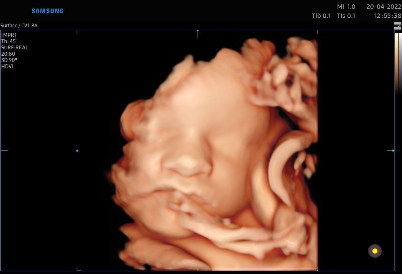 Valentina Conserva-12