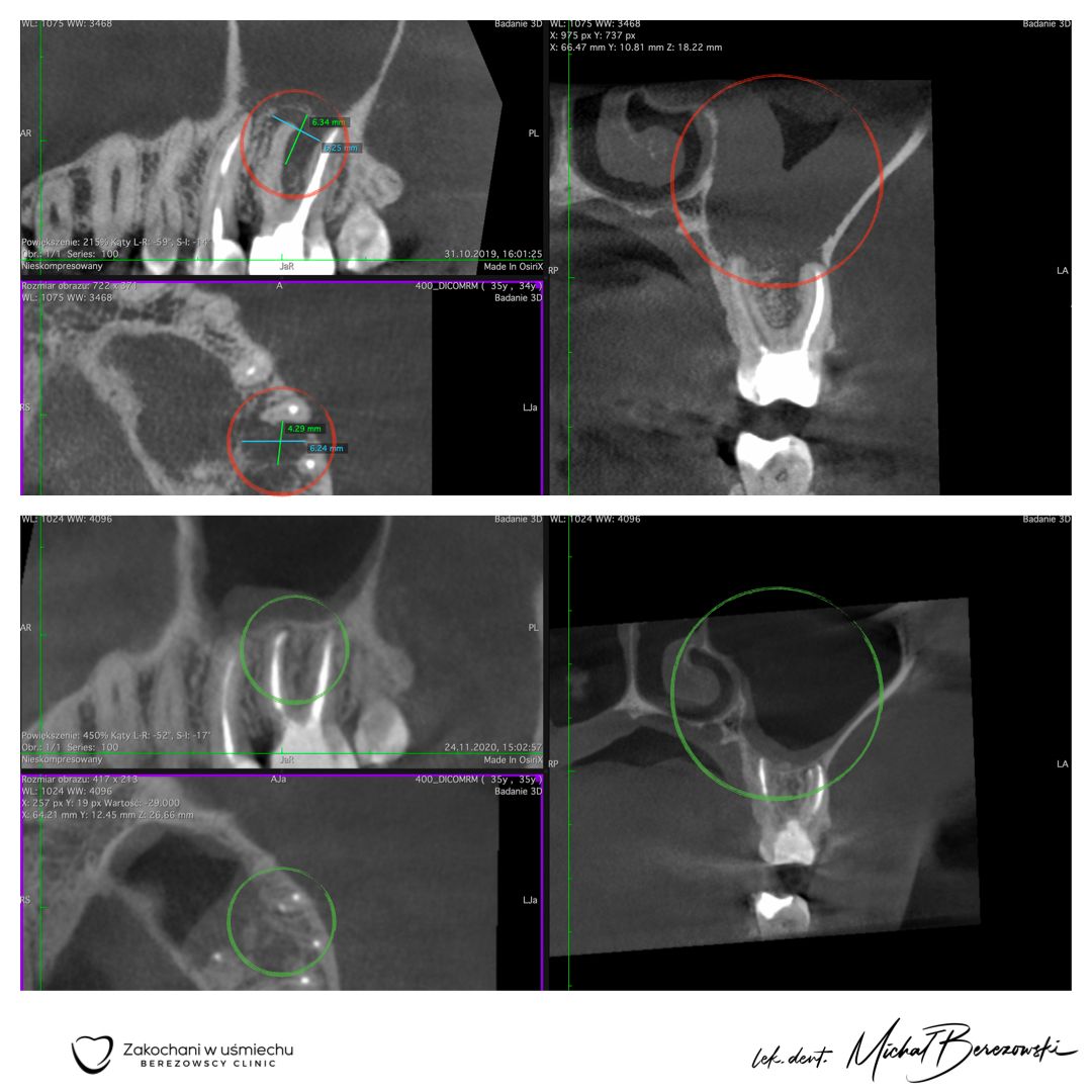 Michał Berezowski-48