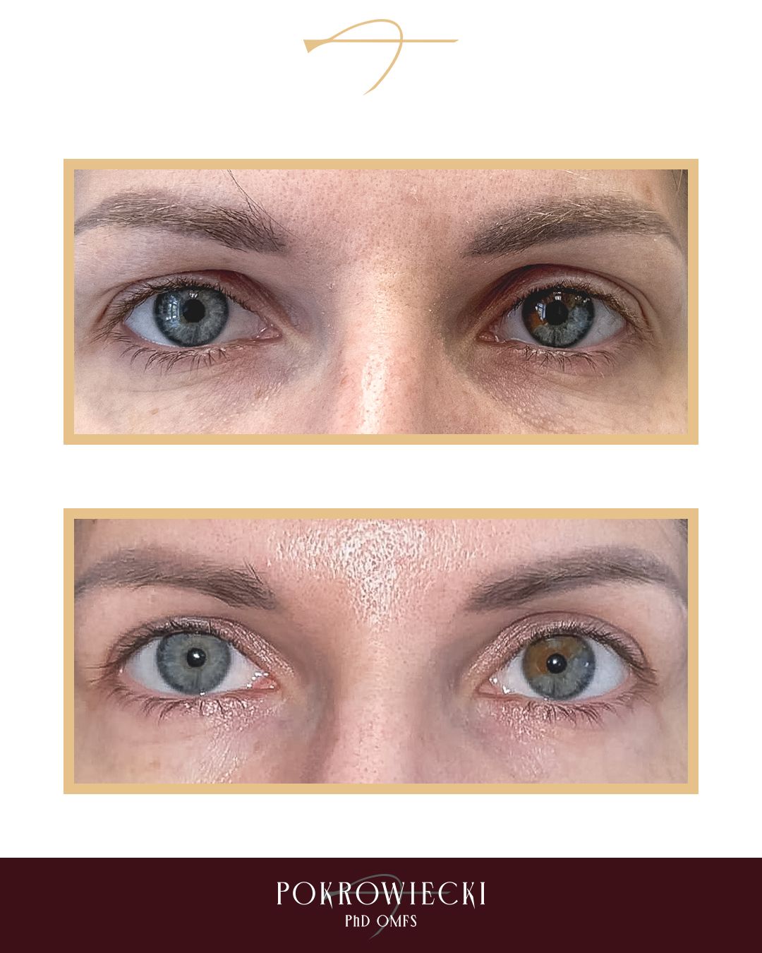 Rafał Pokrowiecki-36