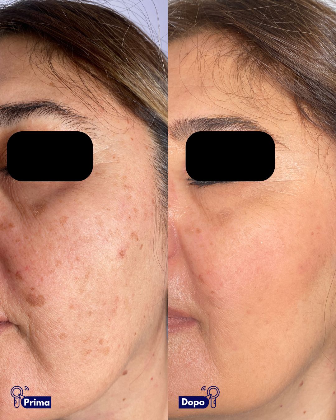 Alfredo Piccerillo-7