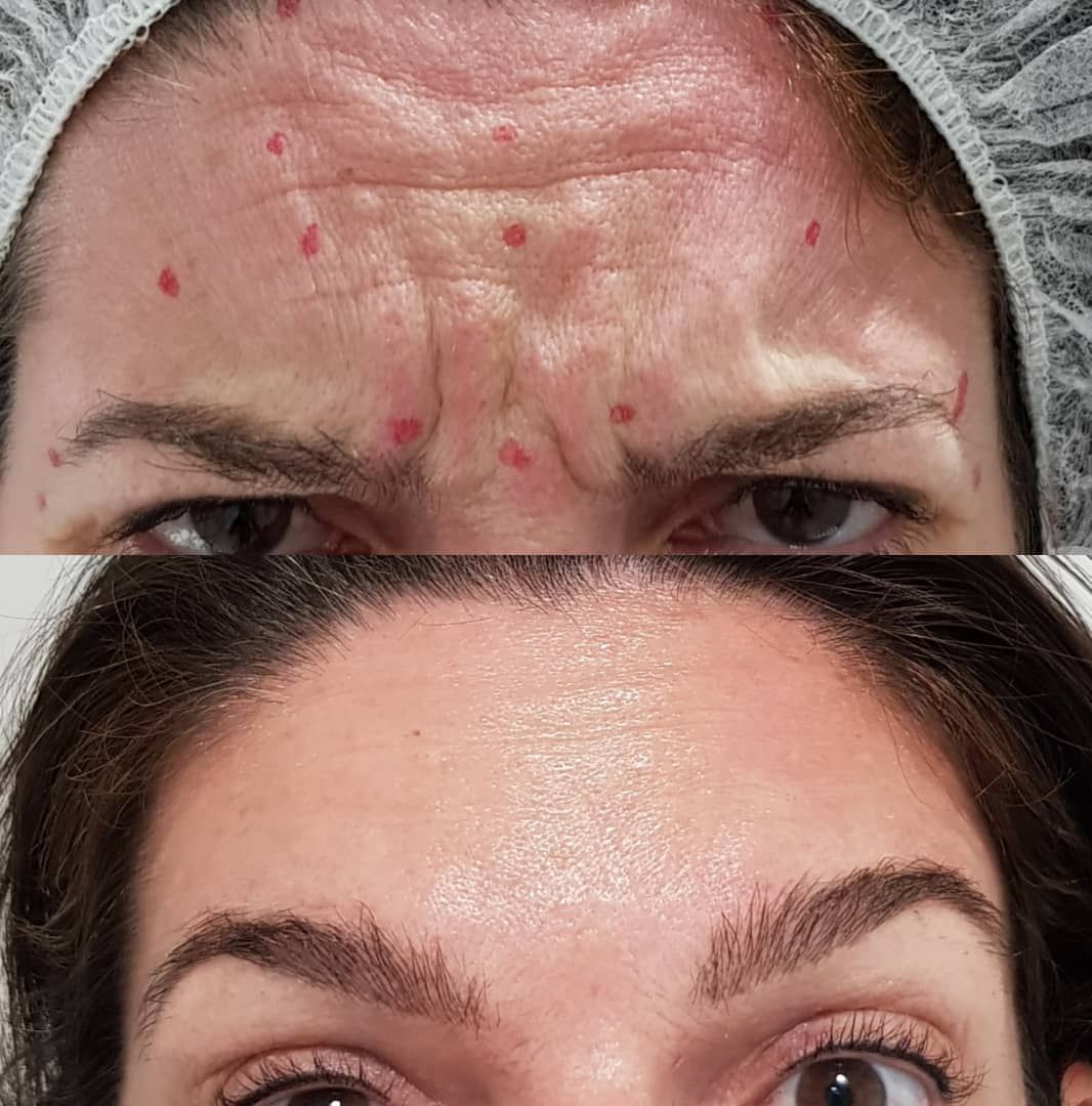 Rosalba Herrero Zerpa-509