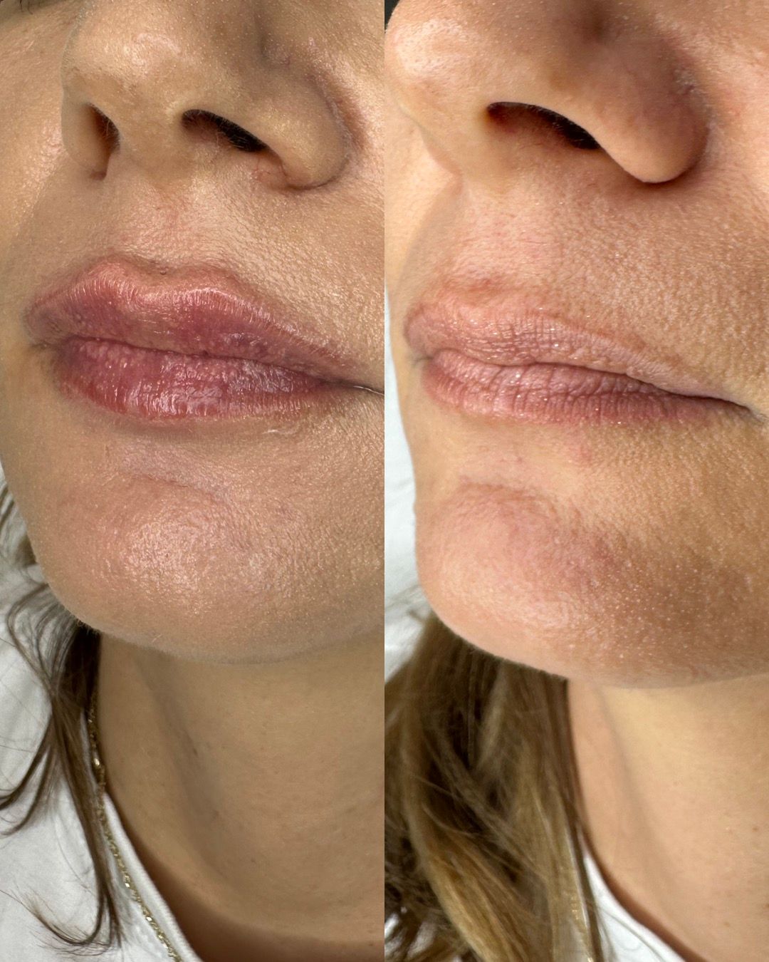 Michalina Zagańczyk-Bączek-37