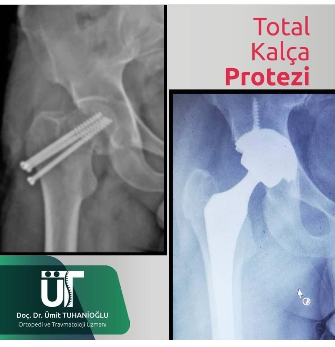 Ümit Tuhanioğlu-11