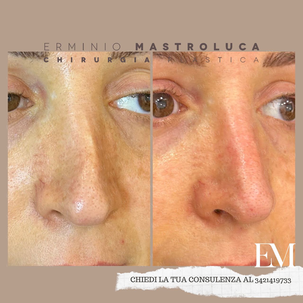 Erminio Mastroluca-9