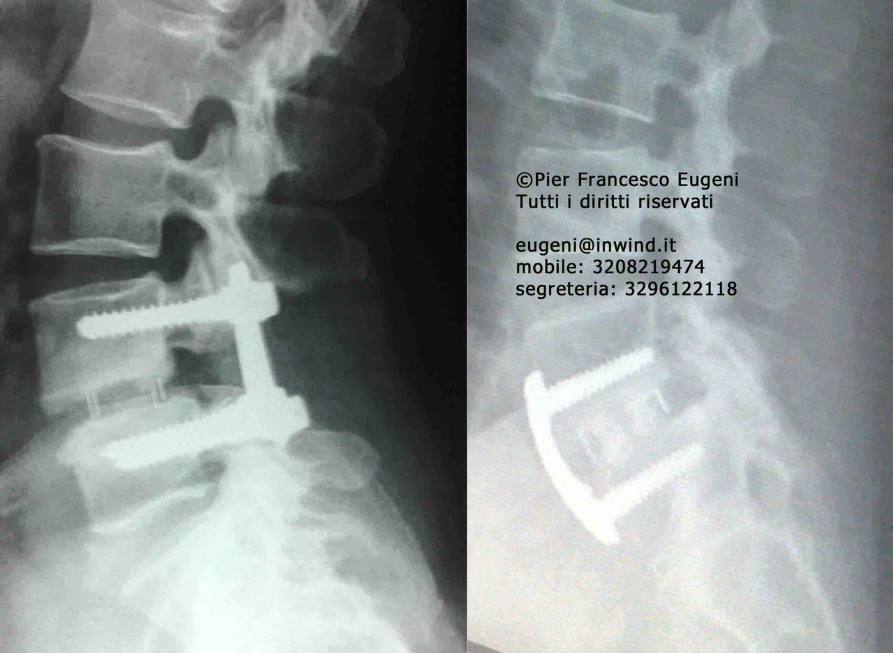 Pier Francesco Eugeni-3