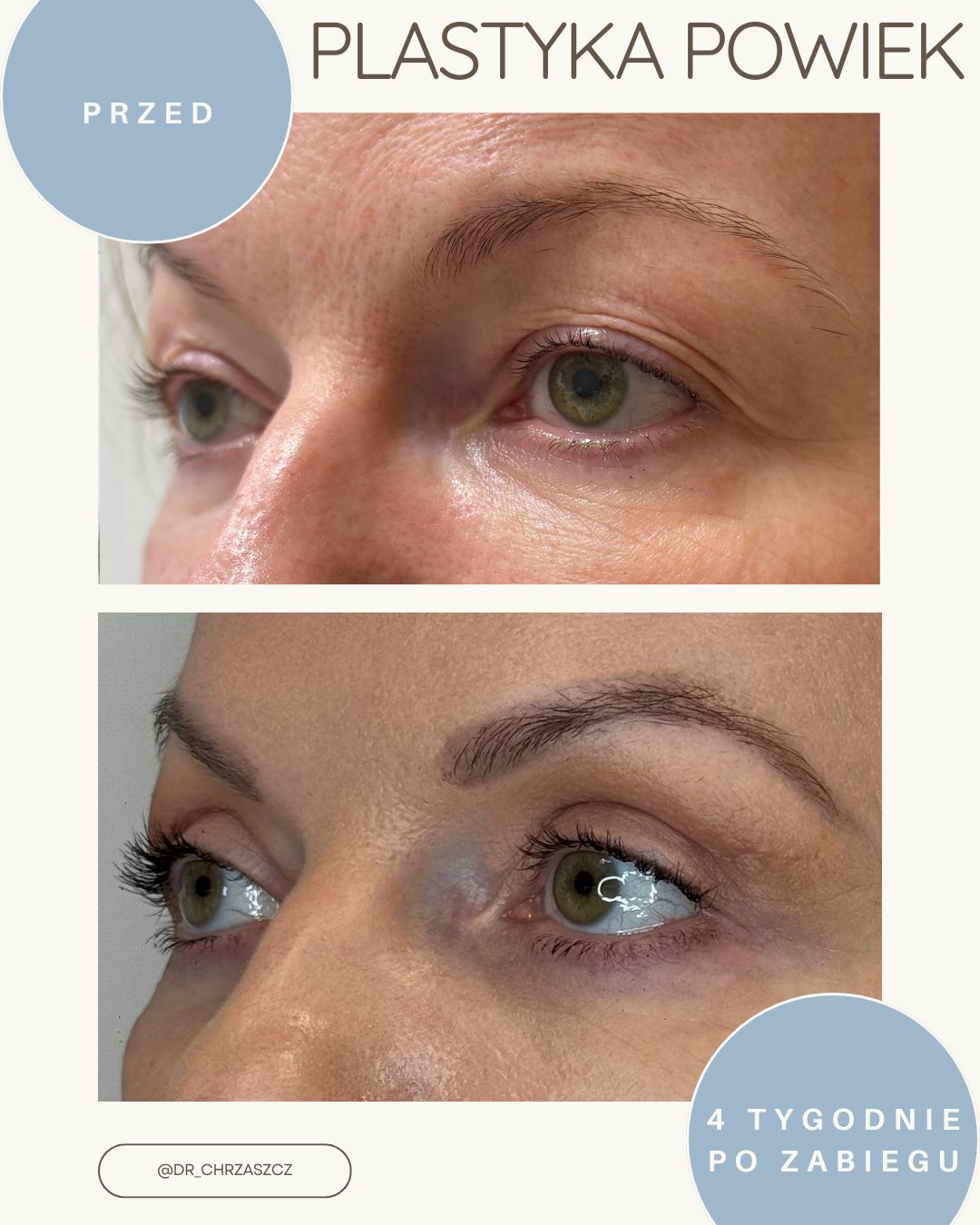 Michał Chrząszcz-1