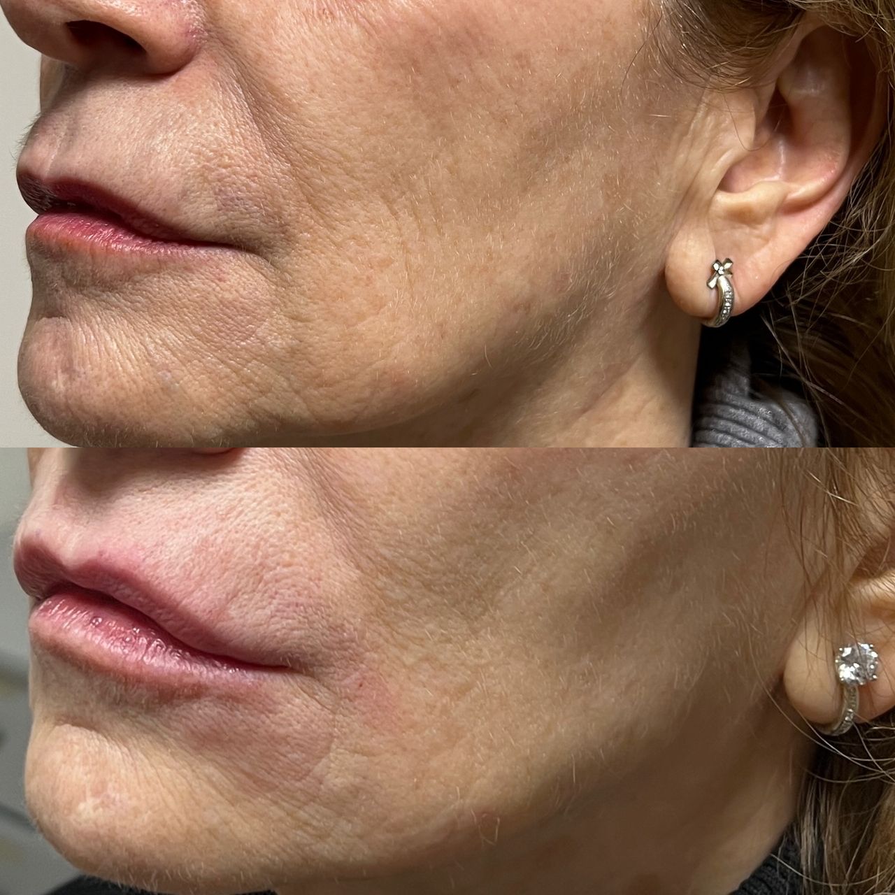 Jacopo Pettinelli-16