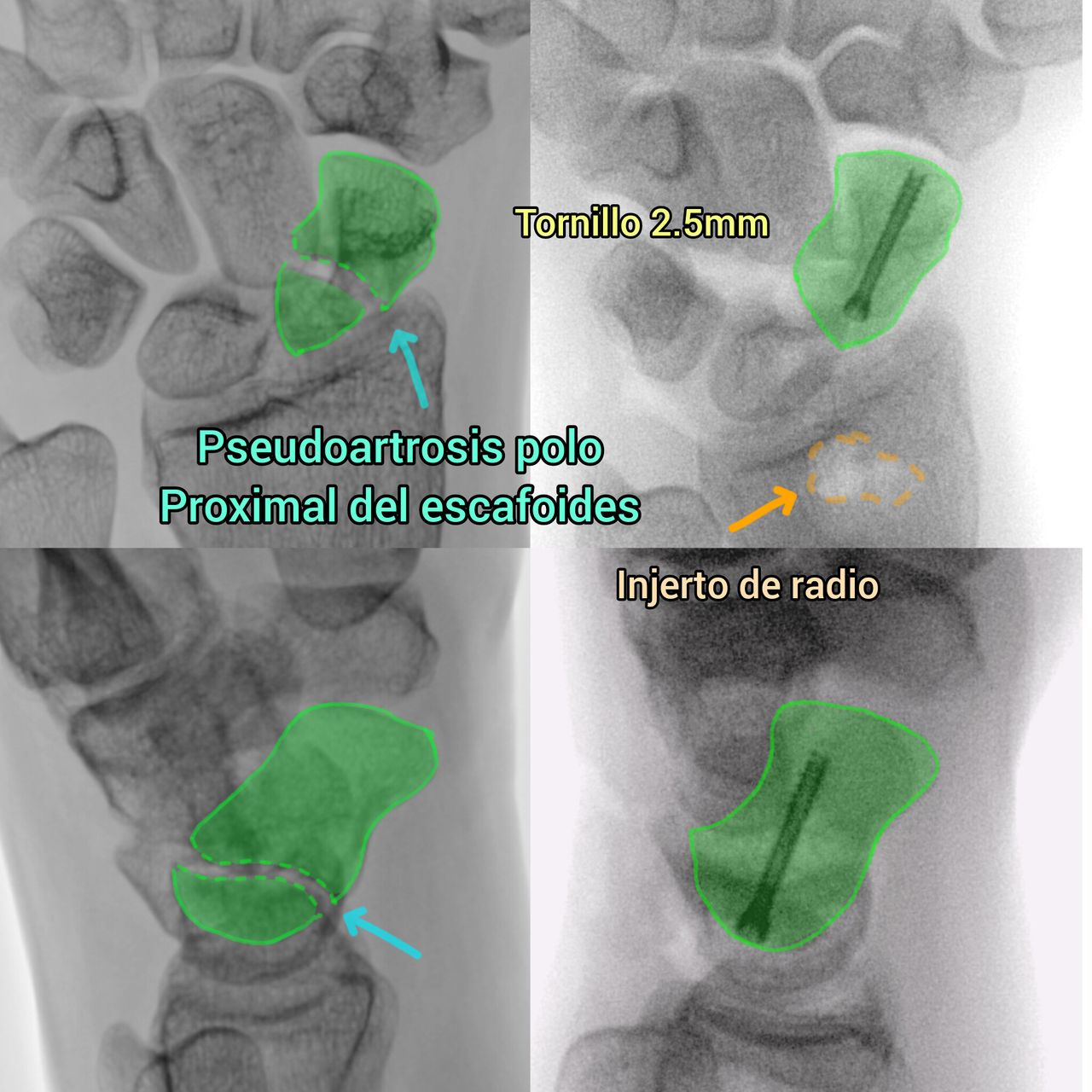 Derlis Sotelo García-12