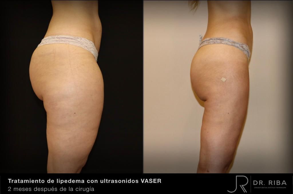 Jordi Riba Vilchez-21