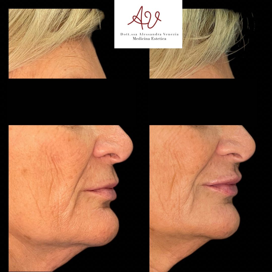 Alessandra Venezia-18