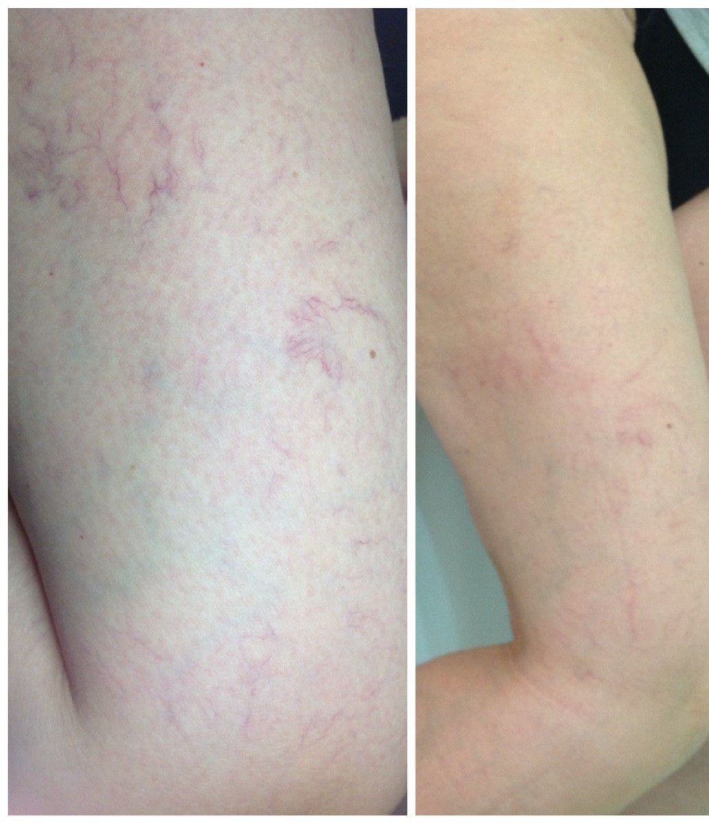 Rosario Antonio Labianca-5