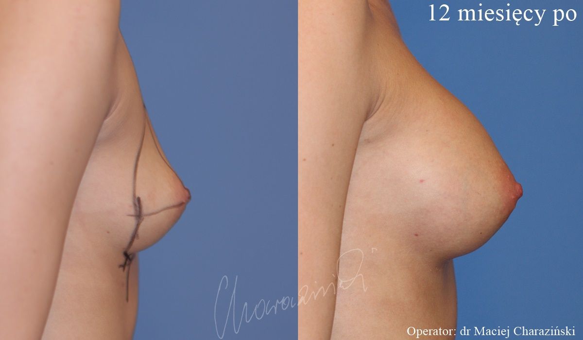 Maciej Charaziński-105