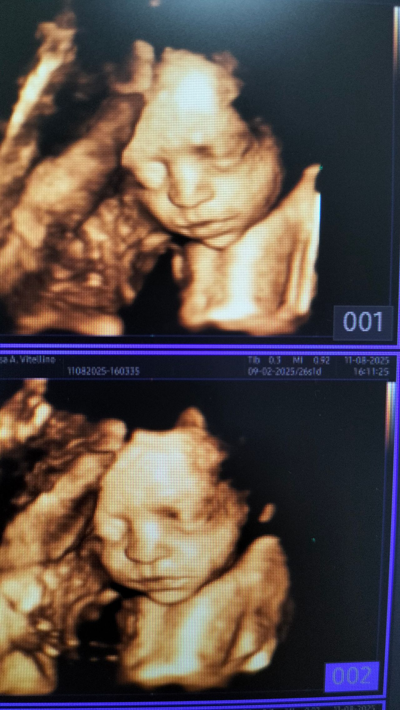 Andreina Vitellino-11